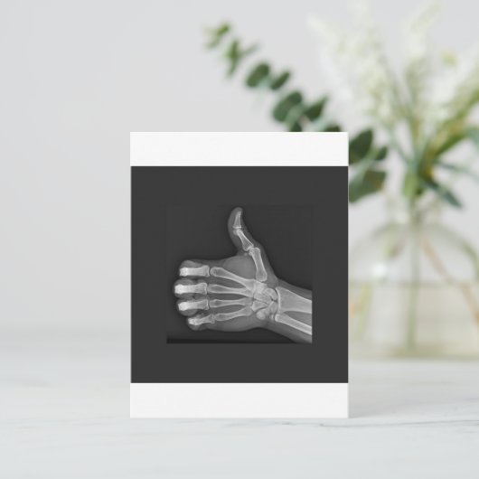 Carte Postale Pouce vers le haut (Debout devant)