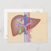 Carte Postale Procédure de transplantation du foie (Devant / Derrière)