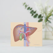 Carte Postale Procédure de transplantation du foie (Debout devant)