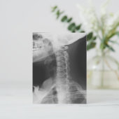 Carte Postale Rayé X 2 (Debout devant)