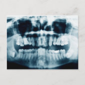 Carte Postale Rayon X des dents (Devant)