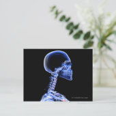 Carte Postale Rayon X des os dans le cou (Debout devant)