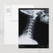 Carte Postale Rayon X des vertèbres du cou, y compris la mâchoir (Devant / Derrière)