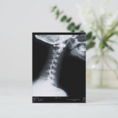 Carte Postale Rayon X des vertèbres du cou, y compris la mâchoir (Debout devant)