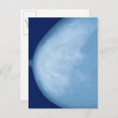 Carte Postale Rayon X du sein féminin, vue latérale (Devant / Derrière)