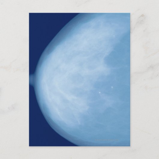 Carte Postale Rayon X du sein féminin, vue latérale (Devant)