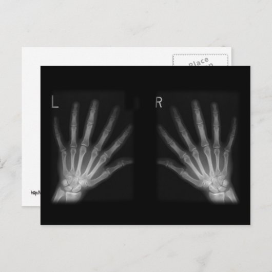 Carte Postale Rayon X numérique supplémentaire, main droite et m (Devant / Derrière)