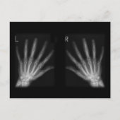 Carte Postale Rayon X numérique supplémentaire, main droite et m (Devant)
