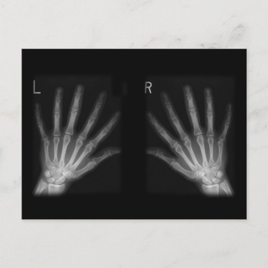 Carte Postale Rayon X numérique supplémentaire, main droite et m (Devant)