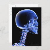Carte Postale Rayon X rapproché des os du cou (Devant / Derrière)