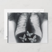 Carte Postale rayons X de papillons dans l'estomac (Devant / Derrière)