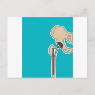 Carte Postale Remplacement du joint de la hanche