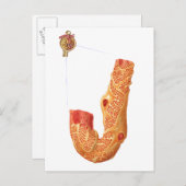 Carte Postale Renal Corpuscle Et L'Membrane De Filtration (Devant / Derrière)