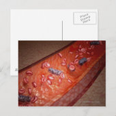 Carte Postale Rendu microscopique d'une infection sanguine (Devant / Derrière)