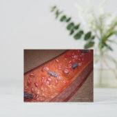 Carte Postale Rendu microscopique d'une infection sanguine (Debout devant)