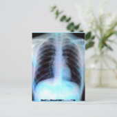 Carte Postale Ribcage Xray Skeleton (Debout devant)