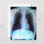 Carte Postale Ribcage Xray Skeleton (Devant / Derrière)