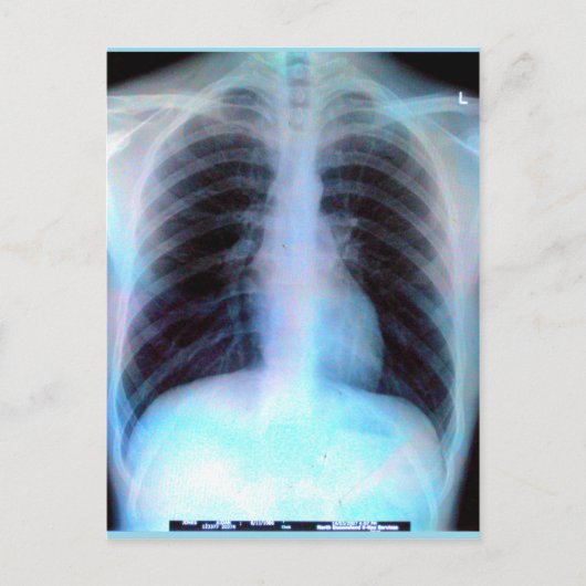 Carte Postale Ribcage Xray Skeleton (Devant)