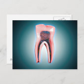 Carte Postale Section D'Une Dent Humaine (Devant / Derrière)