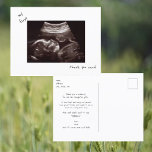 Carte Postale Simple amusant Ultrasound Baby shower Merci<br><div class="desc">Simple Funny Ultrasound Photo Baby shower carte postale Merci. La perspective du bébé. Merci du bébé.</div>