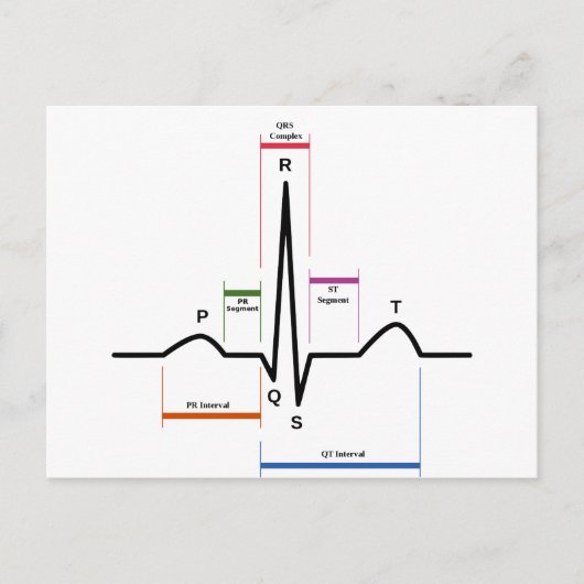 Carte Postale Sinus Rhythm Electrocardiogramme ECG (Devant)