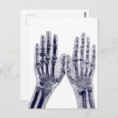 Carte Postale Skeleton Hands Xray Image dessin Anatomie humaine (Devant / Derrière)