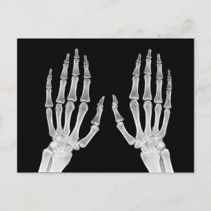 Carte Postale Skeleton Hands Xray Photo Anatomie humaine photo