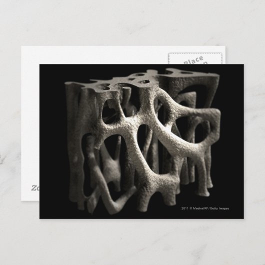 Carte Postale Structure d'un os avec ostéoporose (Devant / Derrière)