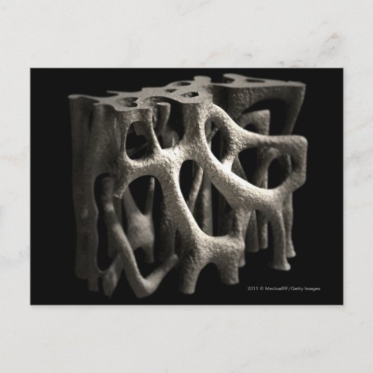 Carte Postale Structure d'un os avec ostéoporose (Devant)