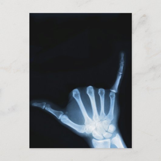 Carte Postale SYMBOLE Shaka X-Ray (Perdre la main) (Devant)