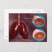 Carte Postale Trachea Transsection Avec Poumons (Devant / Derrière)