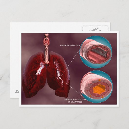 Carte Postale Trachea Transsection Avec Poumons (Devant / Derrière)