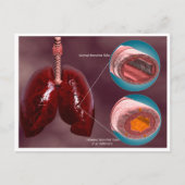 Carte Postale Trachea Transsection Avec Poumons (Devant)