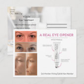 Carte Postale Traitement des yeux des jeunes (Devant / Derrière)