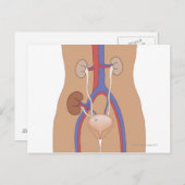 Carte Postale Transplantation rénale (Devant / Derrière)