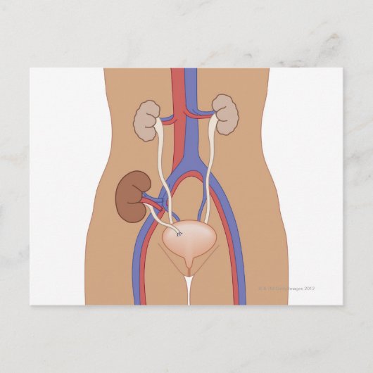 Carte Postale Transplantation rénale (Devant)