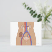 Carte Postale Transplantation rénale (Debout devant)