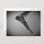 Carte Postale Vue En Rayon X Du Pied Humain 4 (Devant / Derrière)