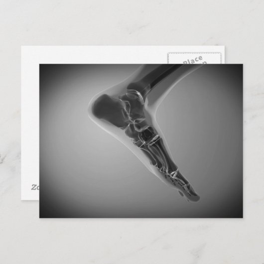 Carte Postale Vue En Rayon X Du Pied Humain 4 (Devant / Derrière)