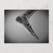 Carte Postale Vue En Rayon X Du Pied Humain 4 (Devant)