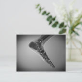 Carte Postale Vue En Rayon X Du Pied Humain 4 (Debout devant)