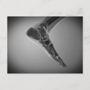 Carte Postale Vue En Rayon X Du Pied Humain 4