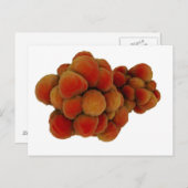 Carte Postale Vue Microscopique De La Tumeur 4 (Devant / Derrière)