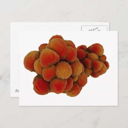 Carte Postale Vue Microscopique De La Tumeur 4 (Devant / Derrière)