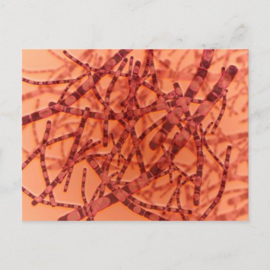 Carte Postale Vue Microscopique De L'Anthrax 3 (Devant)