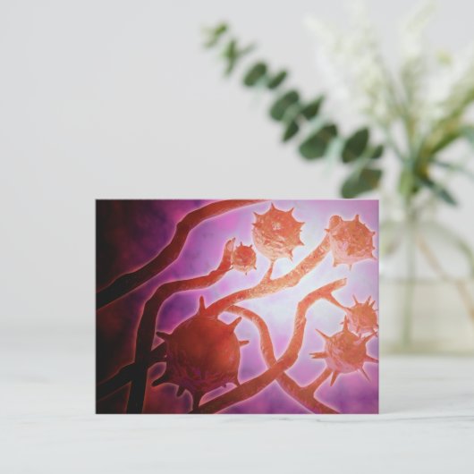 Carte Postale Vue Microscopique De L'Histoplasmose (Debout devant)