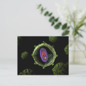 Carte Postale Vue Microscopique Du Virus Du VIH, Section Transve (Debout devant)