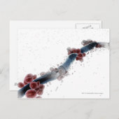 Carte Postale Vue microscopique filaire de candida albicans (Devant / Derrière)