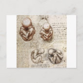 Carte Postale Vues d'un foetus dans le ventre (Devant)