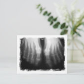 Carte Postale X-Ray Pieds humains Skeleton Bones noir et blanc (Debout devant)